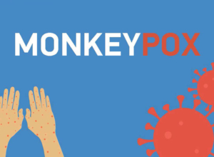 Monkeypox: What you need to know