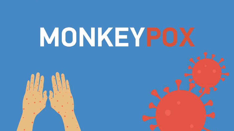 Monkeypox: What you need to know
