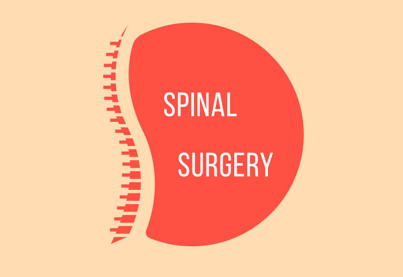 Spinal Surgery graphic